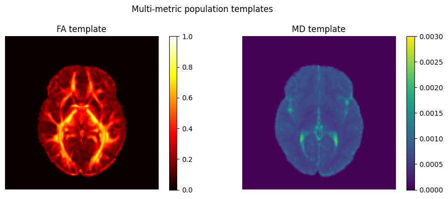 FA and MD population templates